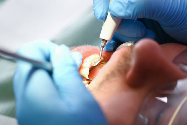 Best Emergency Cosmetic Dentistry (e.g., broken veneers) in Eureka Springs, AR